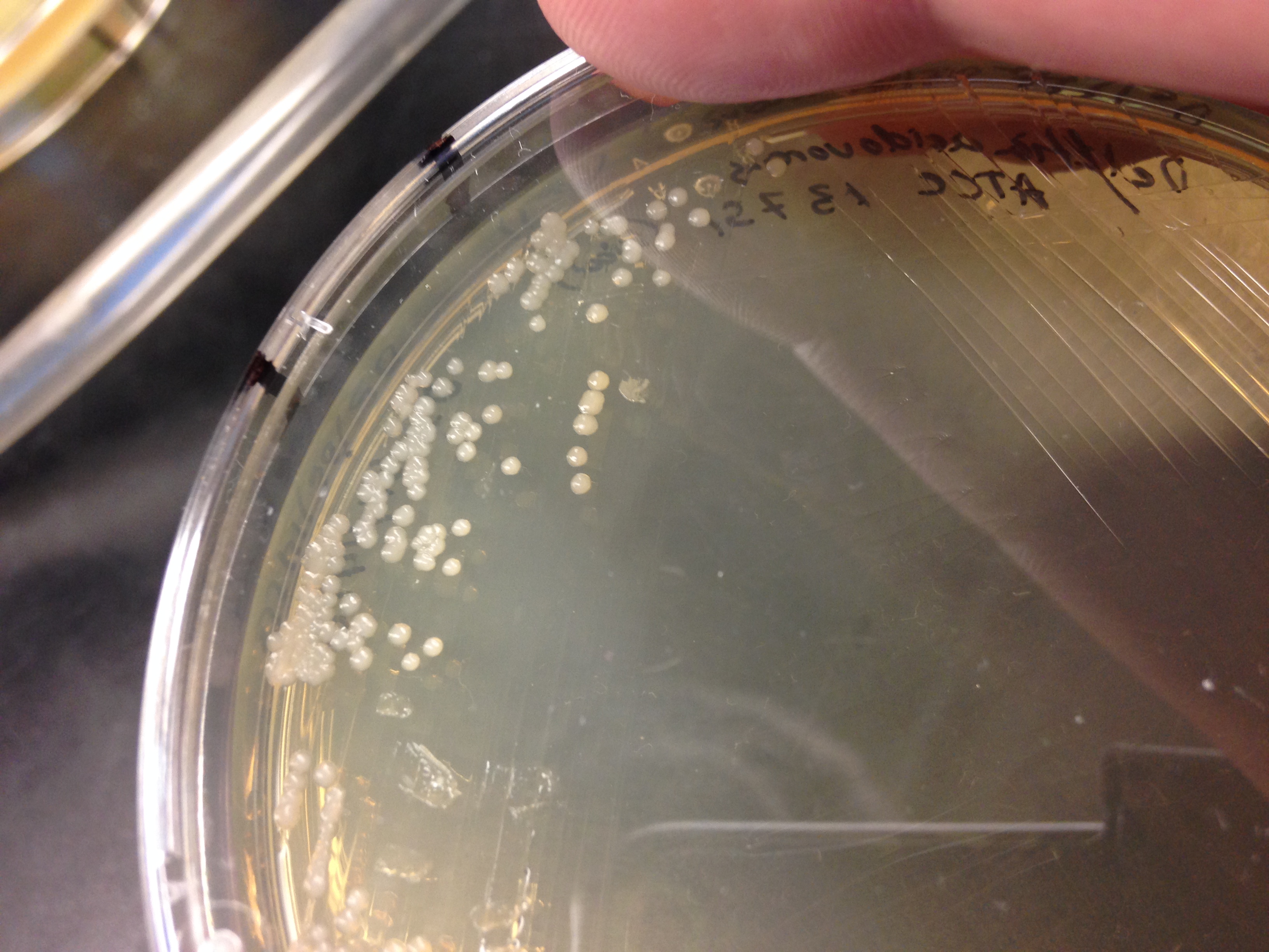 Colonies of Delftia acidovorans on agar